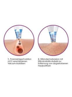 5tlg.-Set: Porenreiniger In Weiß -Hauschks Geschaft cleanmaxx 5tlg set porenreiniger in weiss 8